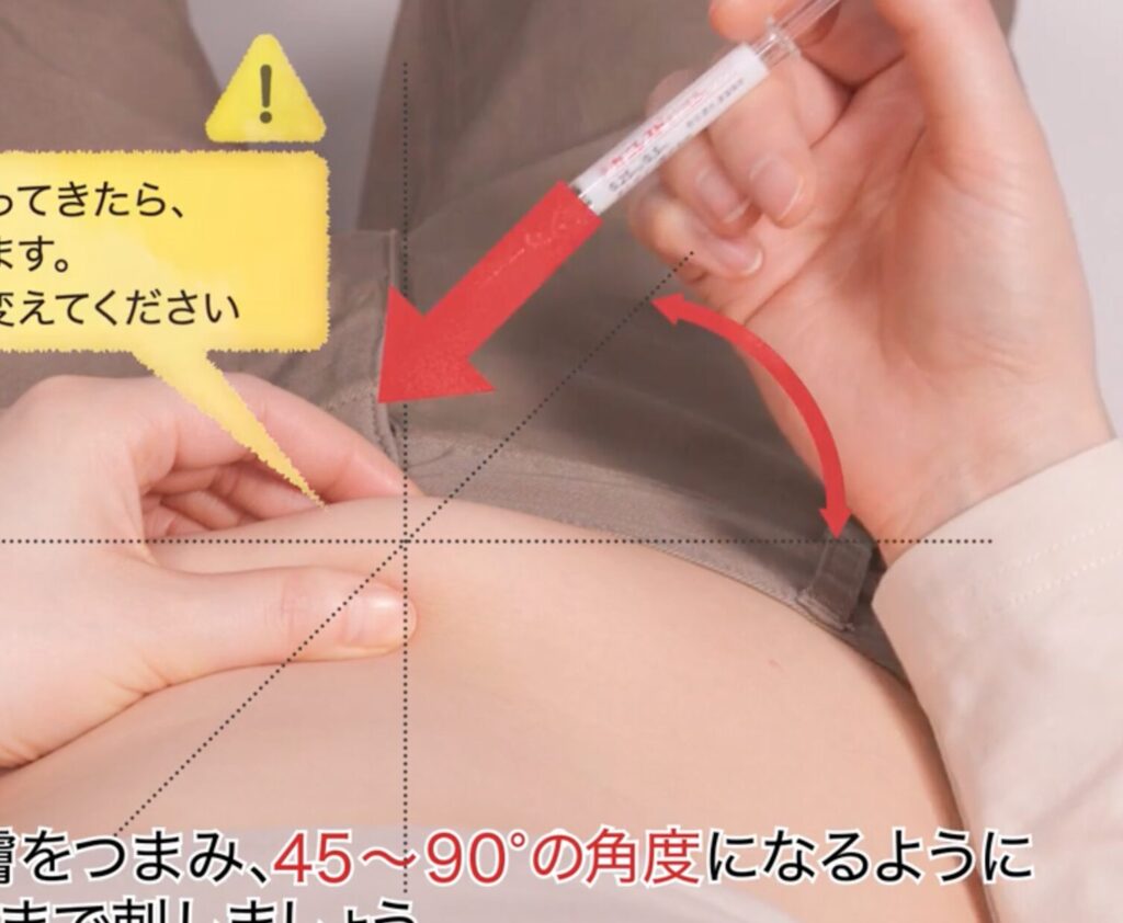 ガニレスト注射角度案内図